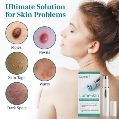 Lepeaa® LumeSkin Mole and Wart Removal Laser Pen