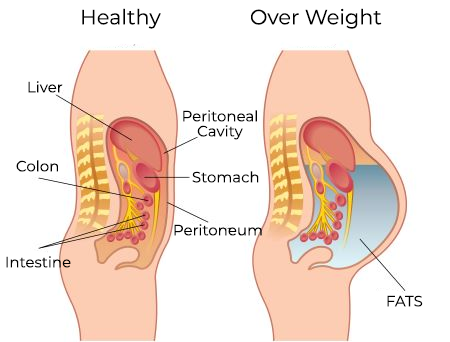 Oveallgo™ BurnUp Żaqq Shaping Garża