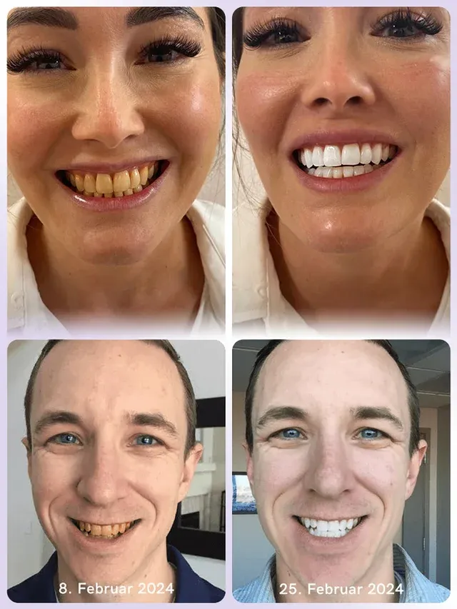 Niooe®Dental cleaning powder