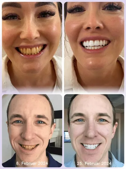 Niooe®Dental cleaning powder