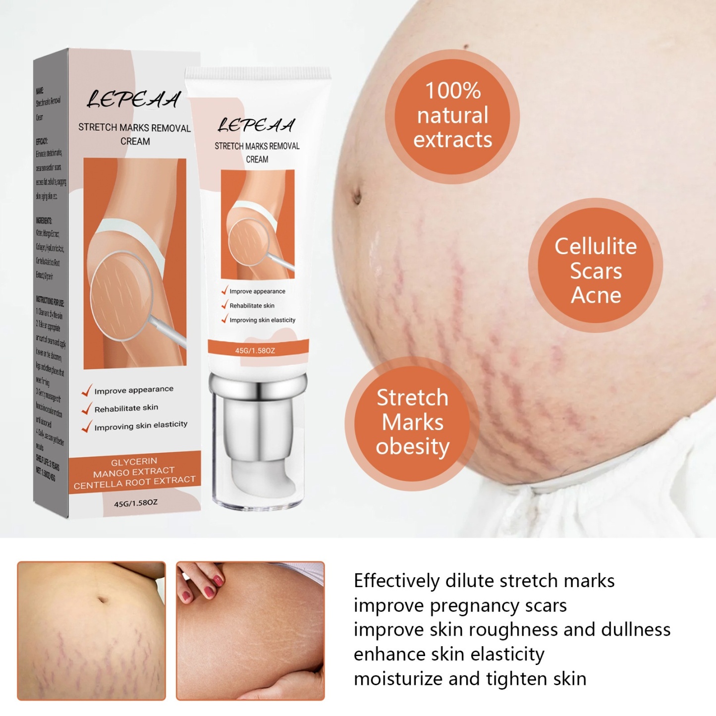 LEPEAA ANTI-VERGETURE CREAM