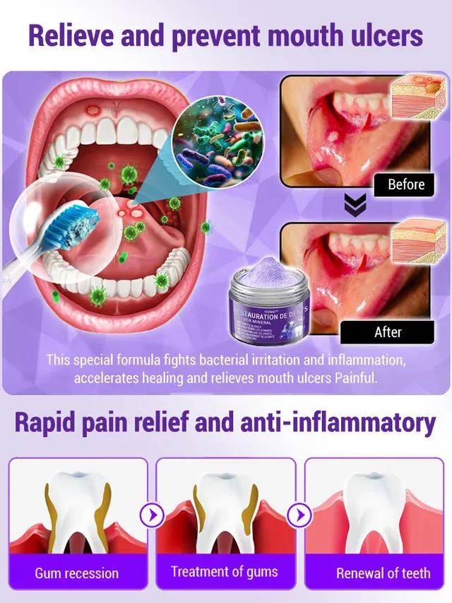 Niooe®Dental cleaning powder