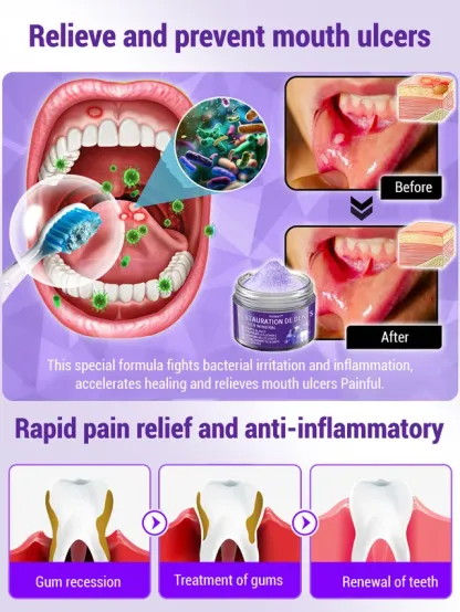 Niooe®Dental cleaning powder