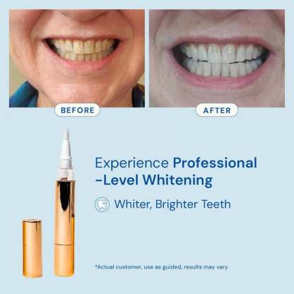 Whitening Pen for Stain Removal & Whiter Teeth