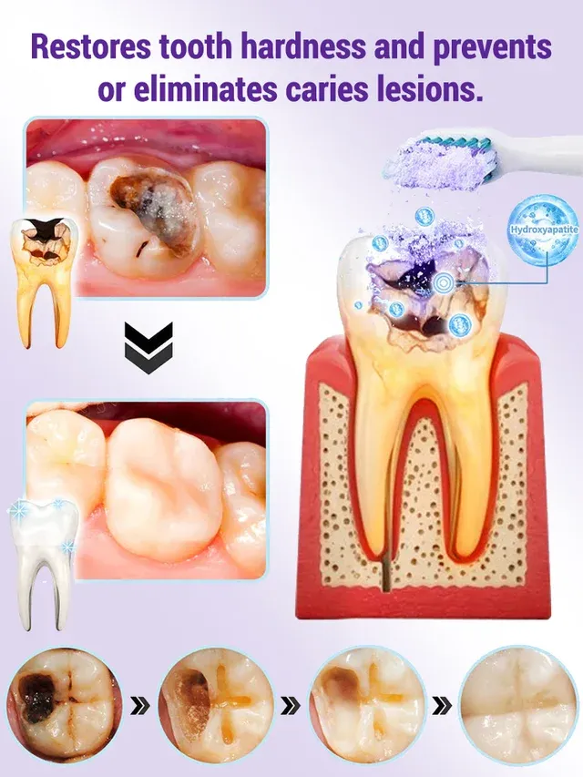 Niooe®Dental cleaning powder