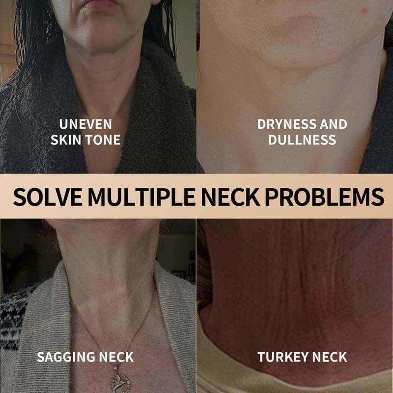 Neck & Eye Care Set – Tighten, Smooth & Hydrate ✨ All-in-One Moisturizing Treatment for Delicate Skin 💧