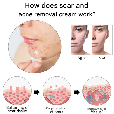 🔥 Last Day Sale 49% OFF - Skin Repair Cream