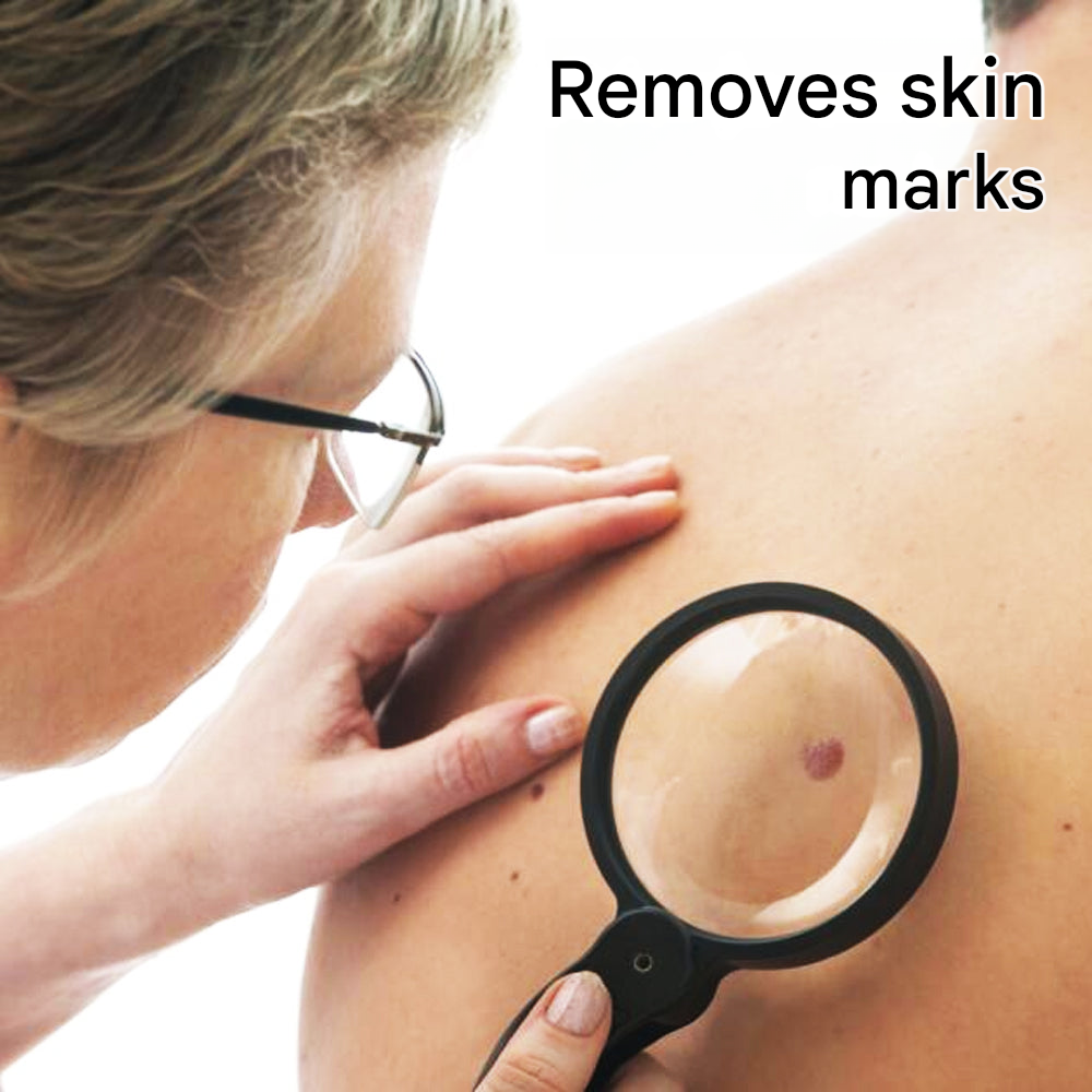 Wart Remover Cream