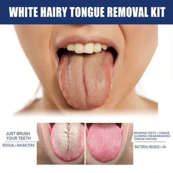 Lepeaa Tongue Cleansing Gel - Fights Bad Breath, Special for Tongue