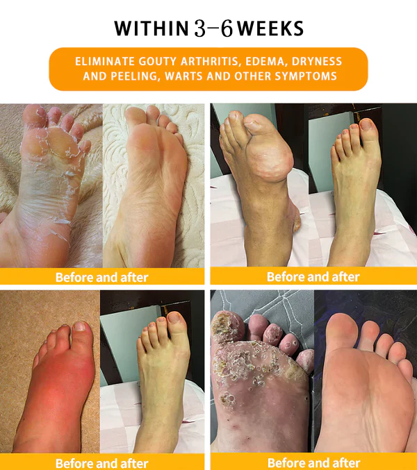 Lepeaa™ 30-Herb Slimming & Detox Foot Bath Beads