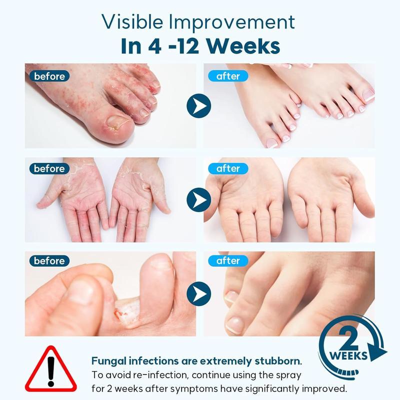 Lepeaa Antimicrobial Foot Sanitizer with Tea Tree Oil