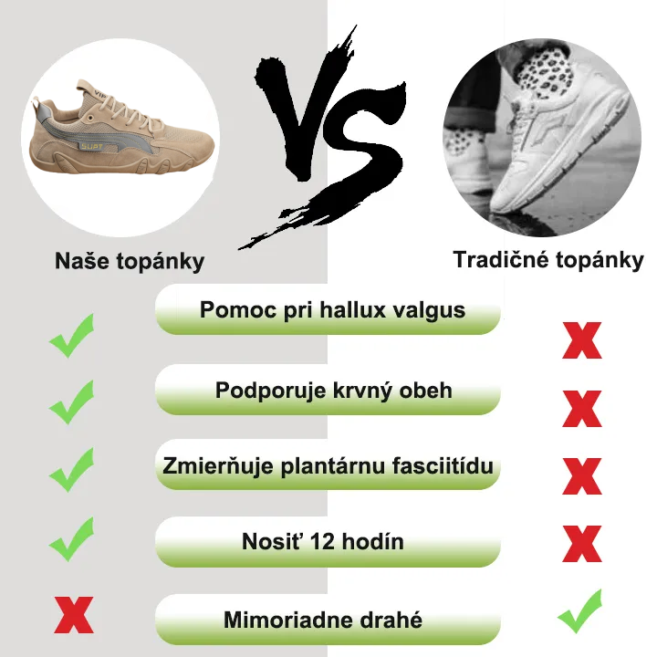 (🔥Dnes sleva 50 % – nenechte si to ujít) ⏰ Prodyšná a pohodlná obuv pro volný čas v horkém stylu 2024 – 🔥Ulevte od bolesti nohou a pat