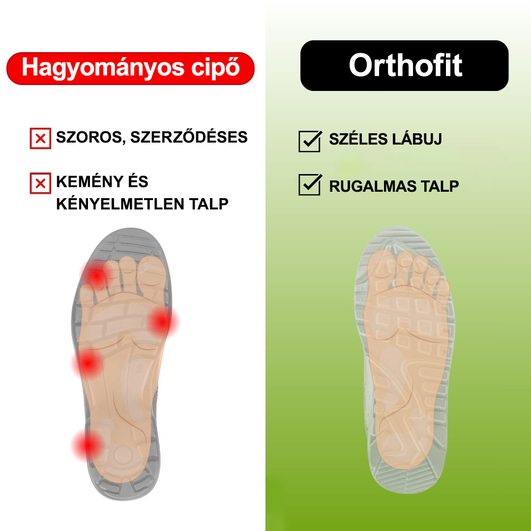 ⏰Ma 50% kedvezménnyel – Légáteresztő ortopéd szandálok nyárra – Három nap a fájdalomproblémák megoldására