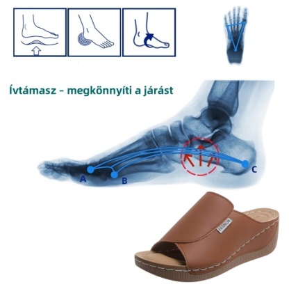 [🎁Ma féláron - ne hagyd ki] Ergonomikus kialakítású ortopéd szandál - fájdalommentes járás 👞 kényelmesebbé teszi a sétát