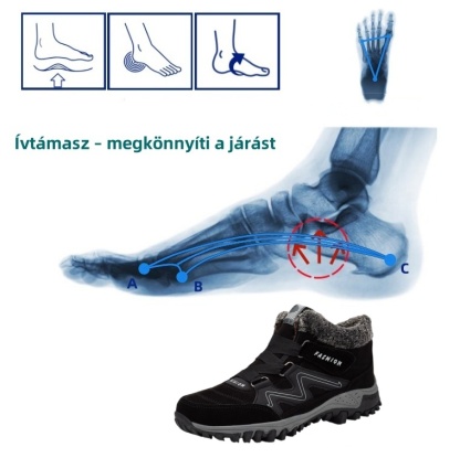 【🎁Halloween-kiárusítás - 50% kedvezmény ma】Ortopéd tornacipők, Ortopéd Orvosok által ajánlott - Megszabadulni a járási kellemetlenségektől👞