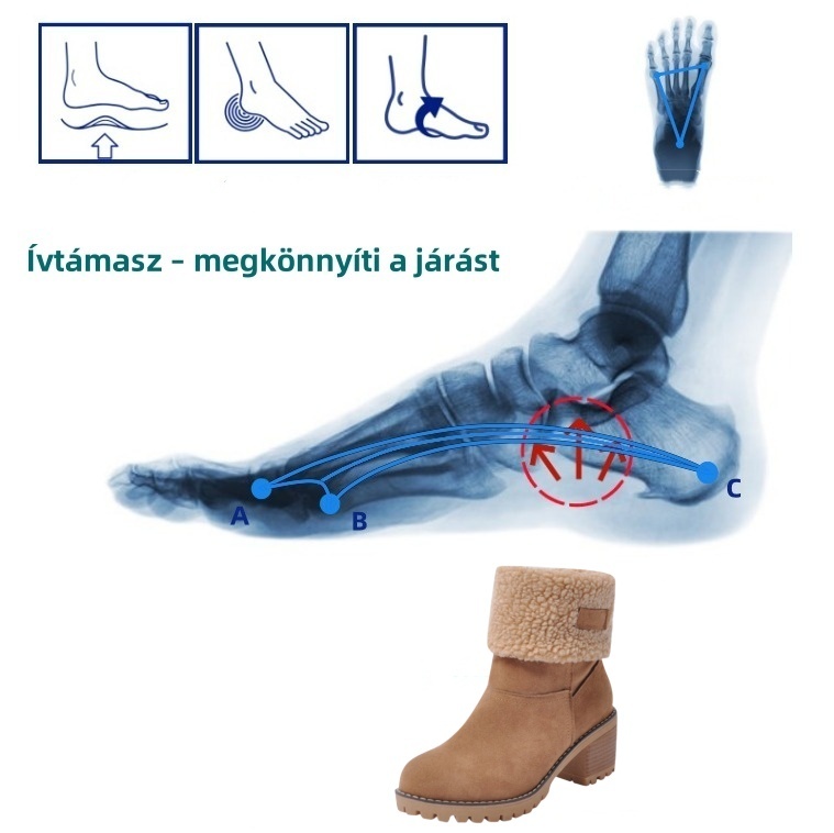 🔥【50% kedvezmény ma - ne hagyd ki】Ergonomikus kialakítású őszi-téli női csizma - fájdalommentes járás, télen meleg, velúr anyagú👞