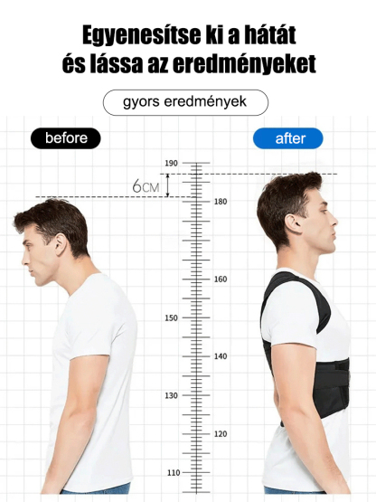 X alakú hátsó korrekciós heveder