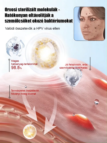 Svájci szakértelem: Sima bőr szemölcsök és hegek nélkül! 