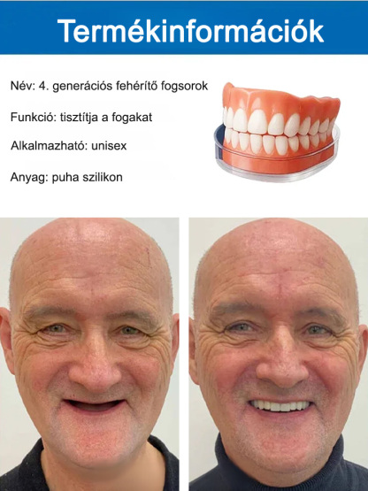 Visszanyert magabiztos mosoly! Az önadaptív anyag stabil illeszkedést garantál: nincs elmozdulás, még alma rágásánál sem.