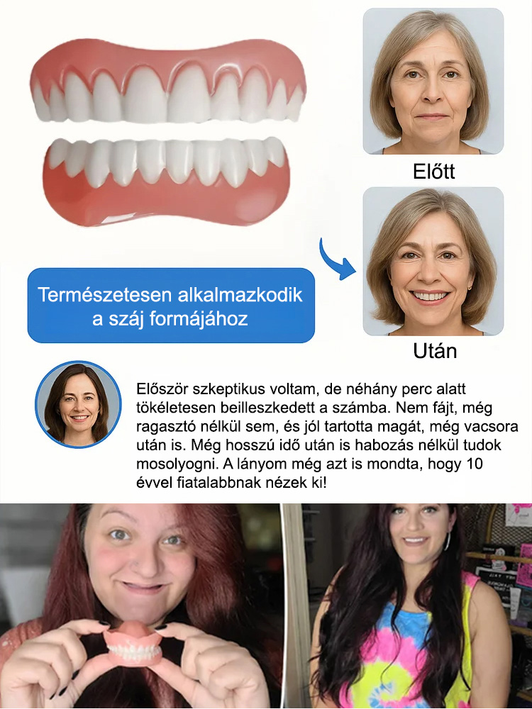 Visszanyert magabiztos mosoly! Az önadaptív anyag stabil illeszkedést garantál: nincs elmozdulás, még alma rágásánál sem.