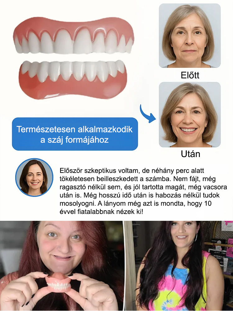 Visszanyert magabiztos mosoly! Az önadaptív anyag stabil illeszkedést garantál: nincs elmozdulás, még alma rágásánál sem.