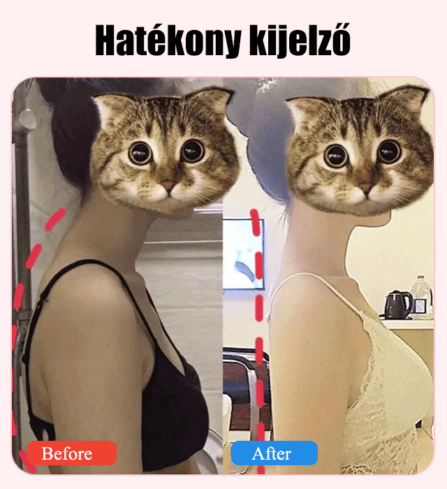 Testtartást korrigáló eszközök