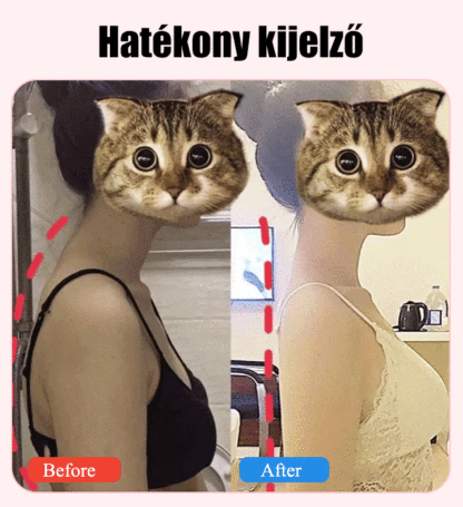 Testtartást korrigáló eszközök