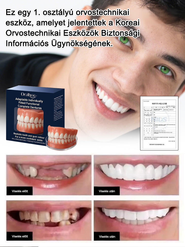 Visszanyert magabiztos mosoly! Az önadaptív anyag stabil illeszkedést garantál: nincs elmozdulás, még alma rágásánál sem.