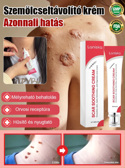 Svájci szakértelem: Sima bőr szemölcsök és hegek nélkül! 