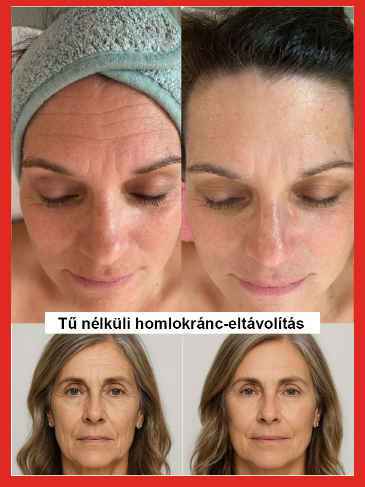 Lazac vízfény ránctalanító szérum