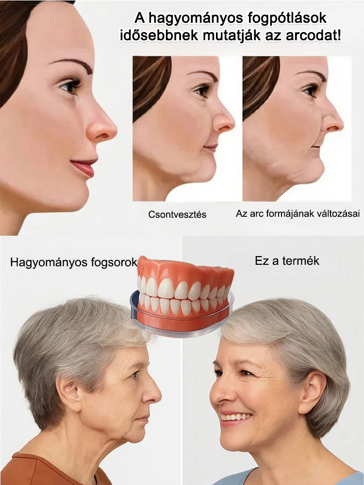 Visszanyert magabiztos mosoly! Az önadaptív anyag stabil illeszkedést garantál: nincs elmozdulás, még alma rágásánál sem.