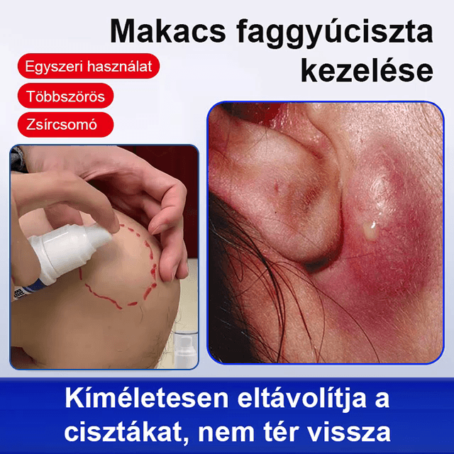 Próbálja ki kockázat nélkül! Ha nem elégedett, visszafizetjük az árát. Ingyenes szállítás.