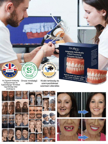 Visszanyert magabiztos mosoly! Az önadaptív anyag stabil illeszkedést garantál: nincs elmozdulás, még alma rágásánál sem.