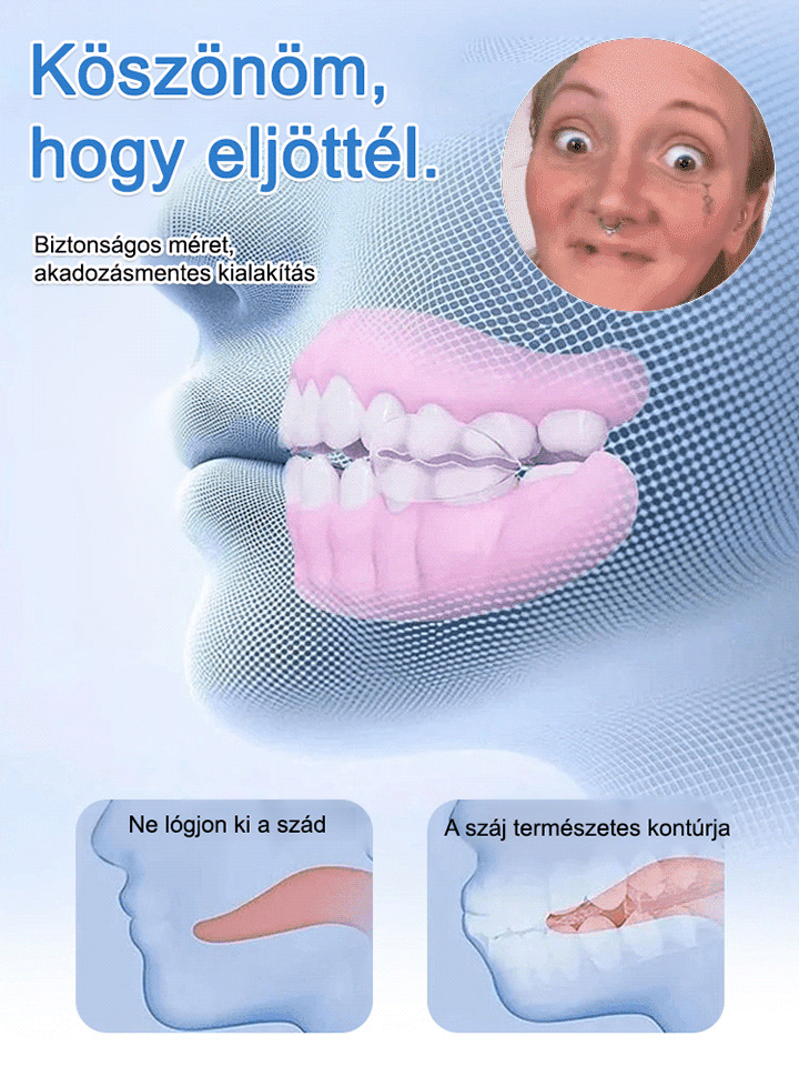 Visszanyert magabiztos mosoly! Az önadaptív anyag stabil illeszkedést garantál: nincs elmozdulás, még alma rágásánál sem.