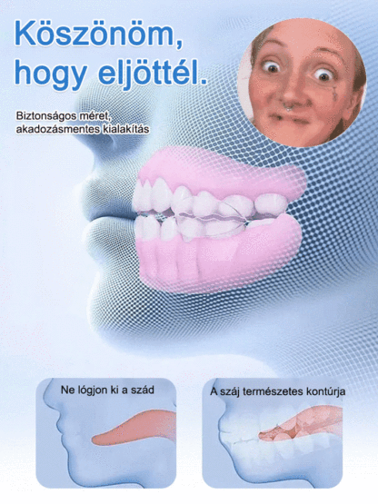 Visszanyert magabiztos mosoly! Az önadaptív anyag stabil illeszkedést garantál: nincs elmozdulás, még alma rágásánál sem.
