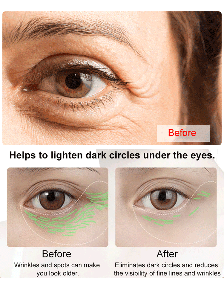 Anti-Falten Augenpflege-Öl