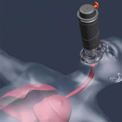 【Saving a Life is Easy】Automatic Choking Rescue Device