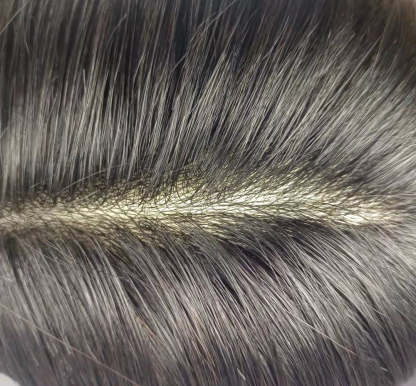Thin Skin 0.04-0.06mm V-loop Front and Reverse Split Knot The Rest of Graft Durable  PU Skin
