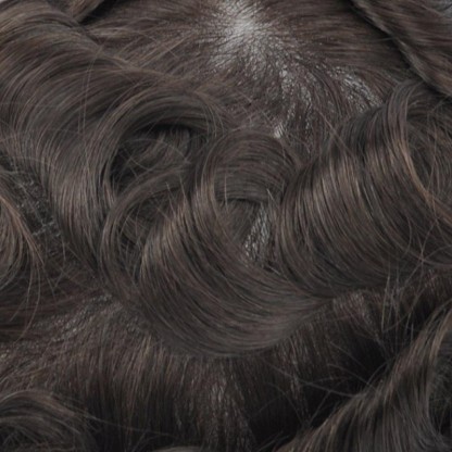 TEMPLE HAIR PATCHES COVERING BALD TEMPLES