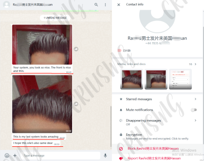 Natural Original Human Hair Patch Breathable and Comfortable with NPU Edge Fully Hand-Tied, for Men and Women