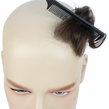 TEMPLE HAIR PATCHES COVERING BALD TEMPLES