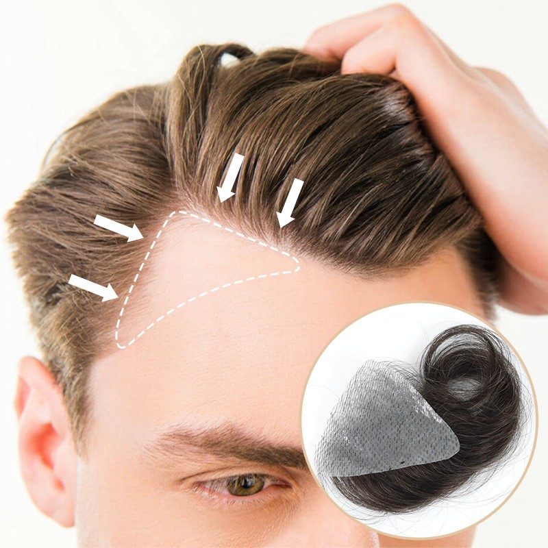 TEMPLE HAIR PATCHES COVERING BALD TEMPLES