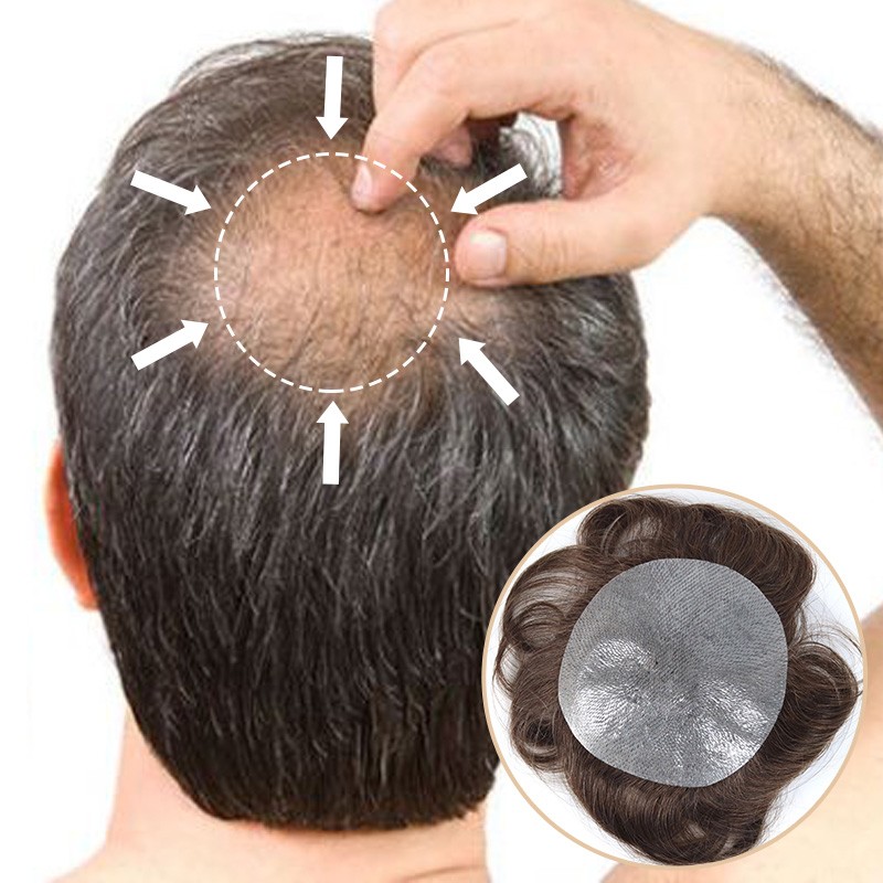 CRIUSWIG HAIR PATCH COVERING THINNING OR BALDING CROWN