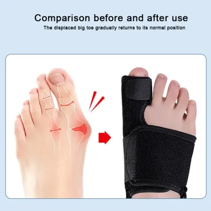 Bunion Device Bigfoot Toe Heavy Camp Toe Splitter Adjustable Day and Night Toe Immobilization Strap