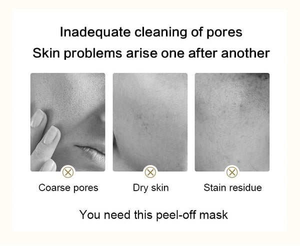 🔥 VÂNZARE HOT: 50% OFF pe masca de aur cu venin de șarpe Retinol"