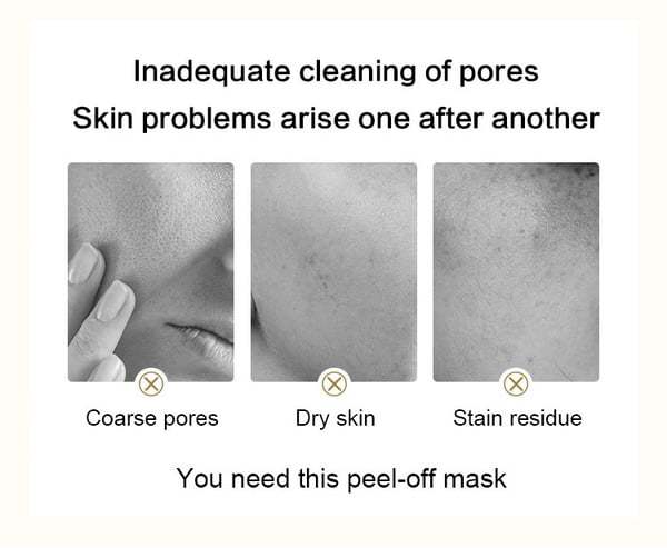 🔥 VÂNZARE HOT: 50% OFF pe masca de aur cu venin de șarpe Retinol"