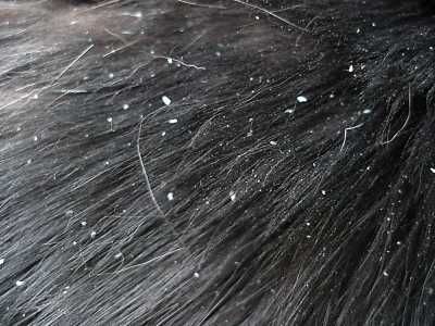 What Is Cat Dandruff?