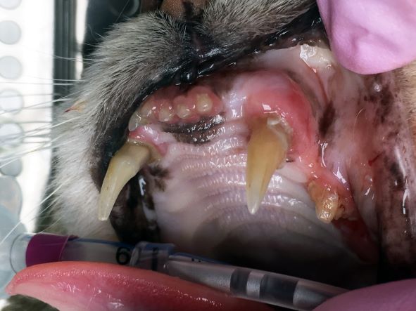 Periodontal disease 