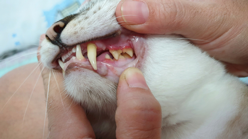 Dental and Oral Health Problems