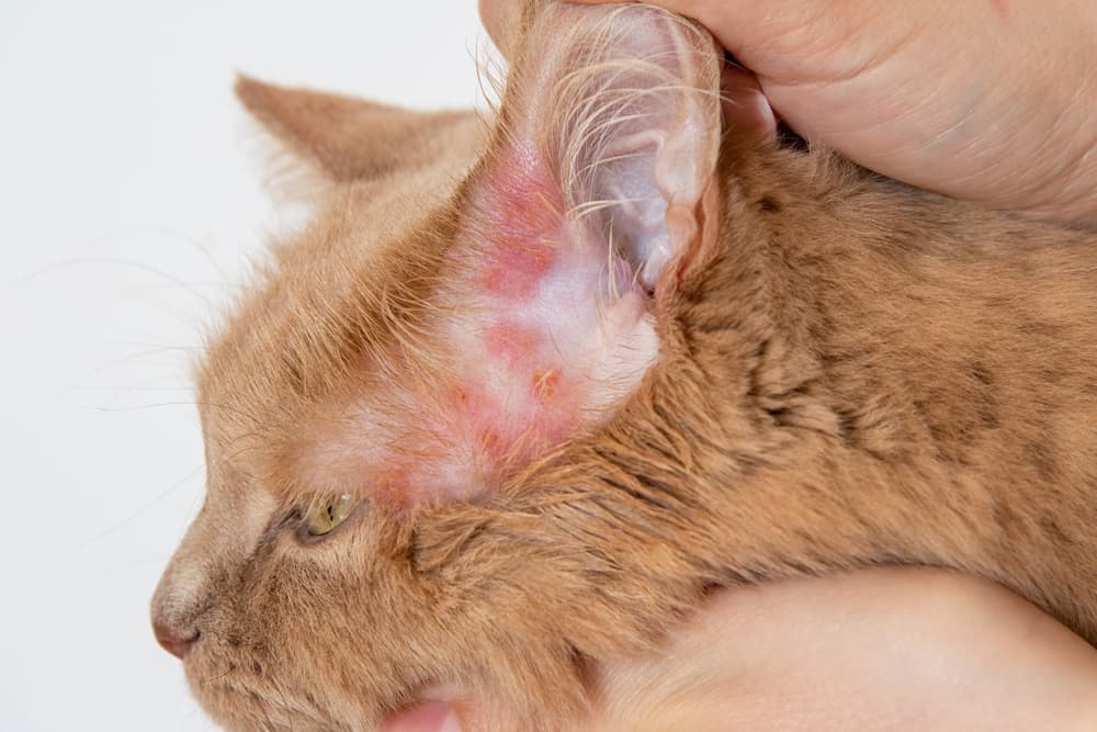 Fungal Infections